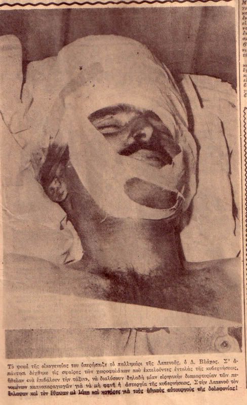 clipping 5